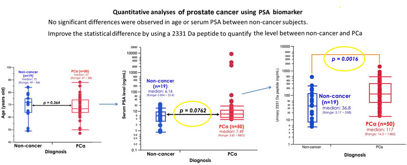 prostate cancer biomarker